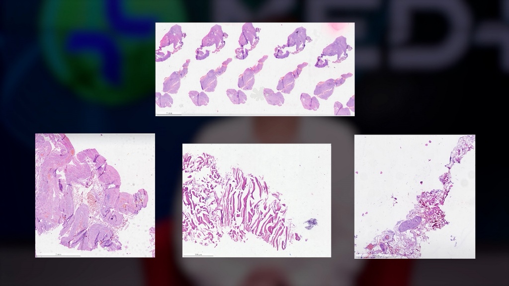 ШІ допоможе українцям діагностувати рак. Що відомо про унікальні сканери